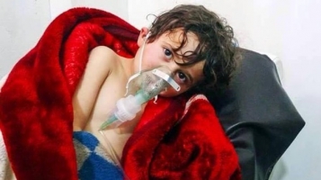 “كلور” الأسد .. سلاح فتاك عمره 100 عام