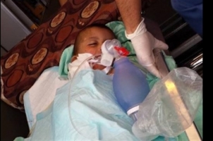 استشهاد طفل فلسطيني حرقا على يد مستوطنين جنوب نابلس