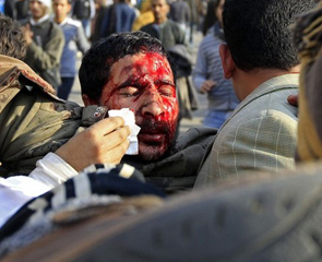 مصر تعلن حالة الطوارئ وحظرا للتجول بعد مقتل 95 شخصا