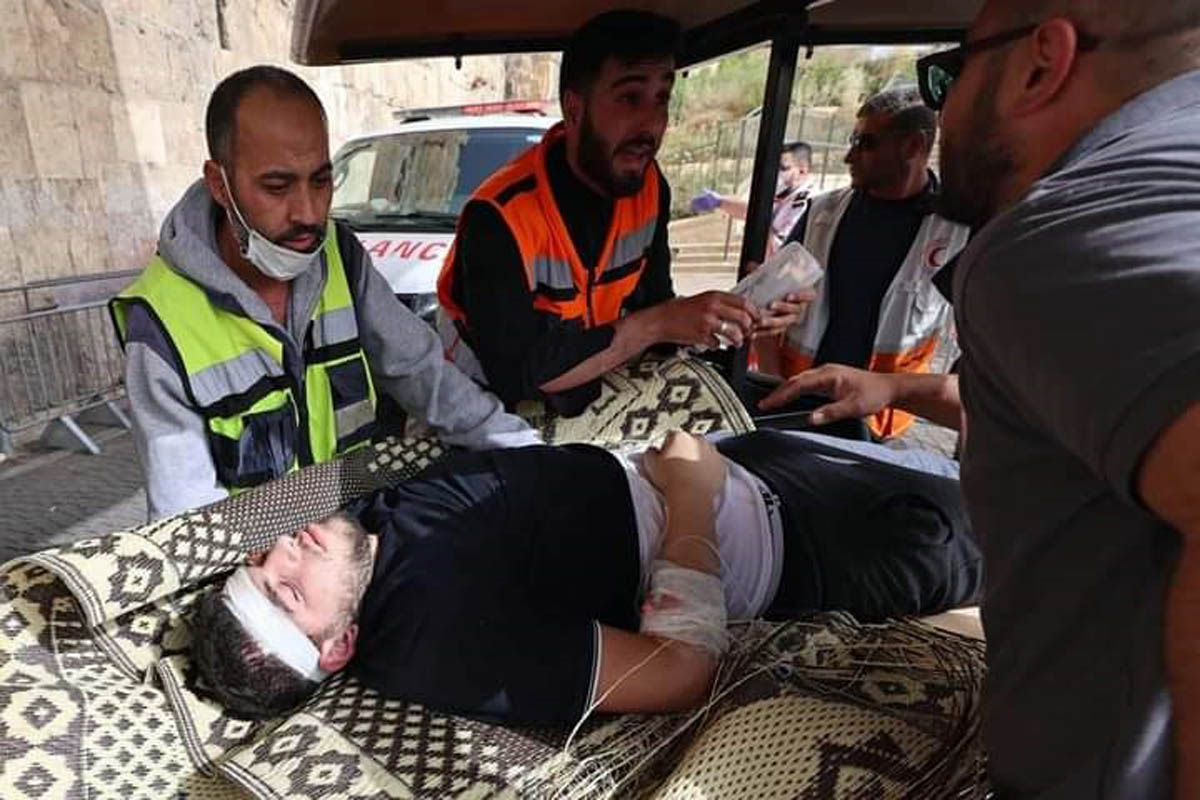القدس: 175 اصابة والعديد منها بالاعين خلال اقتحام الاقصى