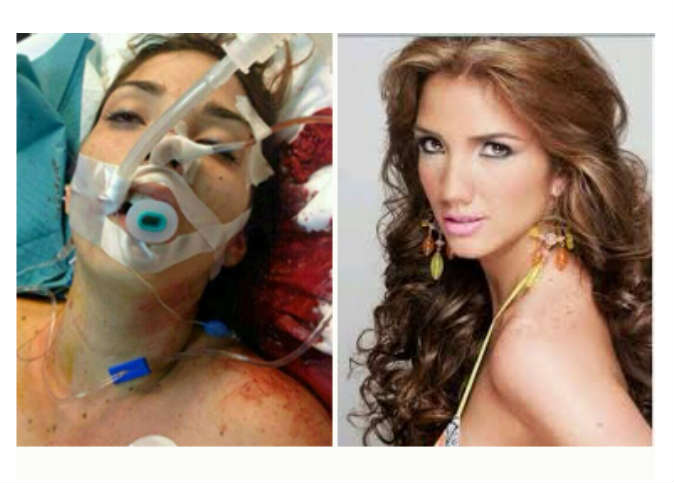مقتل ملكة جمال فنزويلا برصاصة في الرأس