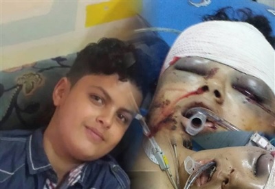 بسبب ضربة كرة.. مسلح حوثي يقتل طفلاً في إب