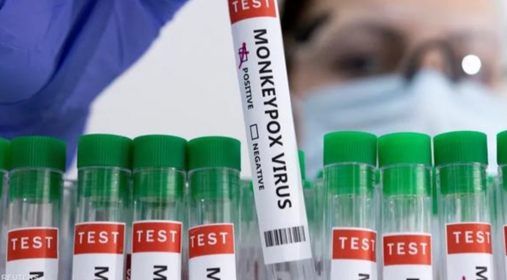 تطور خطير لجدري القرود