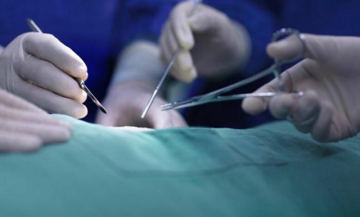 تغريم طبيب أردني 40 الف دينار قطع جزءاً أثناء عملية “طهور” طفل
